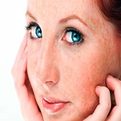 Чувствителна кожа