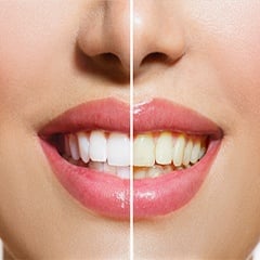 Избелващи продукти за зъби