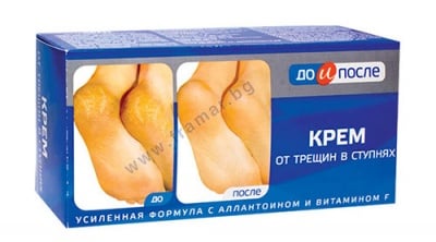 ДО И ПОСЛЕ КРЕМ ЗА НАПУКАНИ ПЕТИ И СТЪПАЛА 50 мл