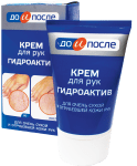 ДО И ПОСЛЕ ХИДРОАКТИВ КРЕМ ЗА