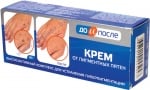 ДО И ПОСЛЕ КРЕМ ПРОТИВ ПИГМЕНТНИ ПЕТНА 50 мл